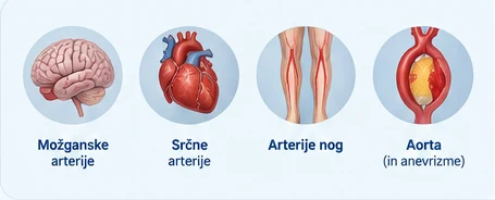 Ilustracije možganskih, srčnih in nožnih arterij ter aorte