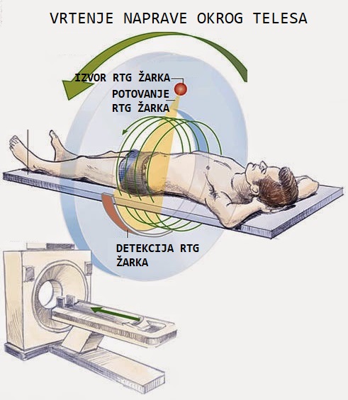 Krožna struktura aparata omogoča, da rentgenski žarrek poruje skozi telo od mesta izvora do mesta zajema.