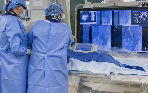 Pri zdravljenju anevrizme abdominalne aorte z ENDO tehniko je manj zapletov, bolniki hitro okrevajo in je hospitalizacija kratka