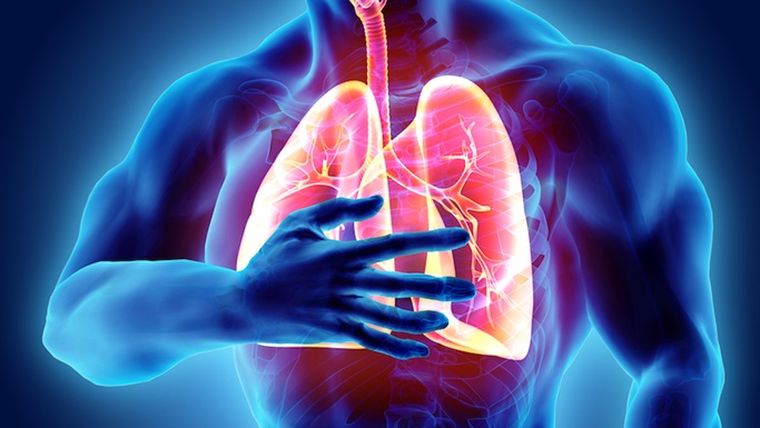Zgodnje prepoznavanje strdka v pljučih lahko pomeni za bolnika ugoden izhod zdravljenja
