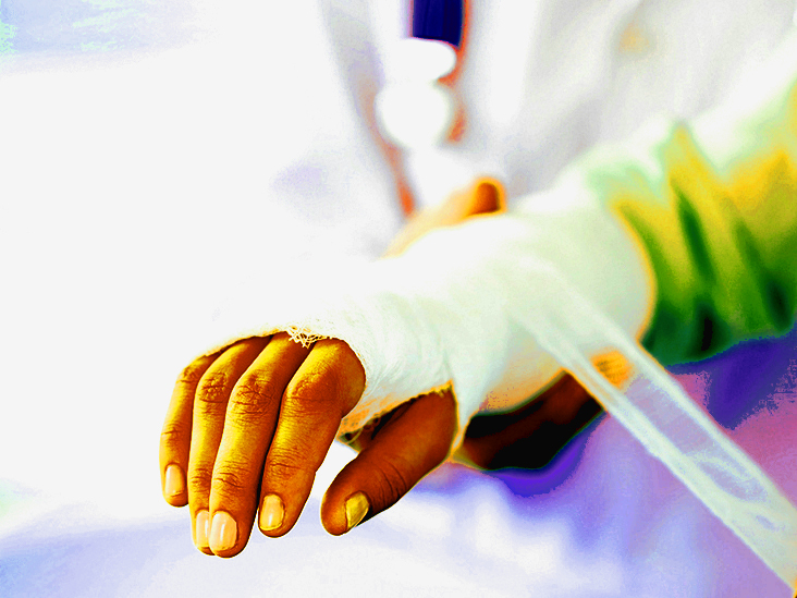 Konzeravativno zdravljenje poškodbe roke