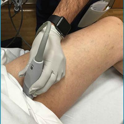 Položaj bolnika pri ultrazvočnem Dopplerskem pregledovanju ožilja